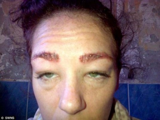 Era să orbească după o vizită la cosmetician